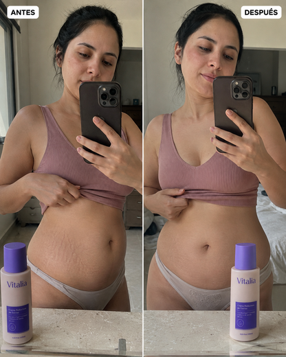 Lozana® Suaviza & Minimiza Crema Reductora de Estrías